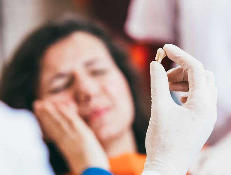 Teeth Extractions